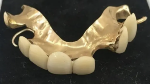 Winston Churchill’s False Teeth